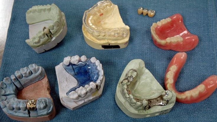 치아 크라운 종류